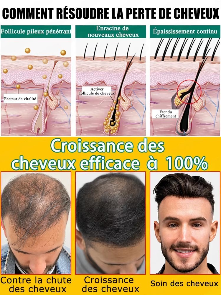 Natural Ginger Hair Care Essen - Hair Care For Hair Fall incelemesi ve fiyatı