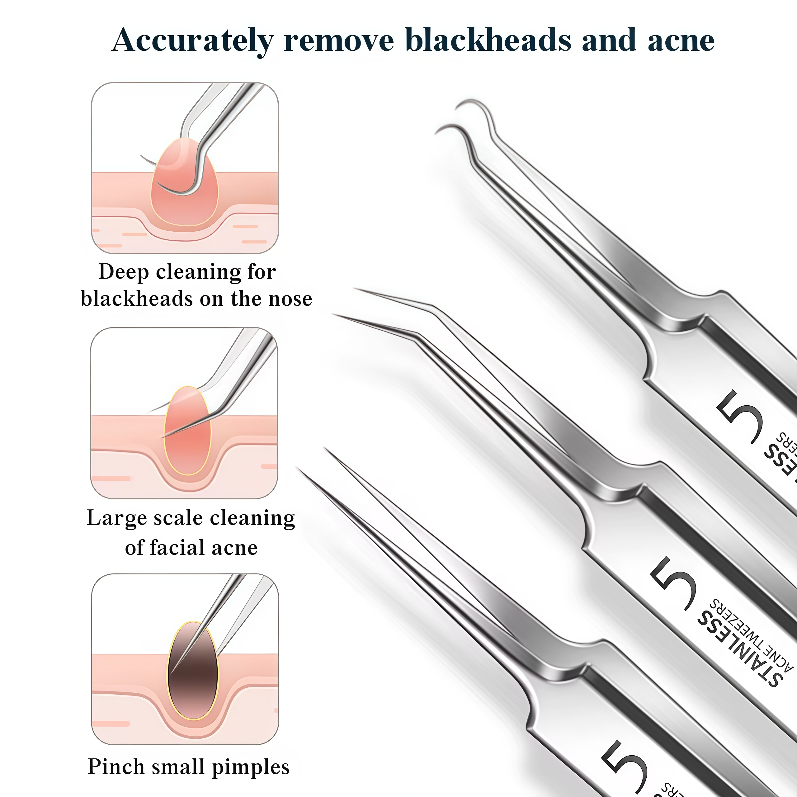 4-11Pcs Ingrown Hair Tweezers  - Hair Care Clinic incelemesi ve fiyatı
