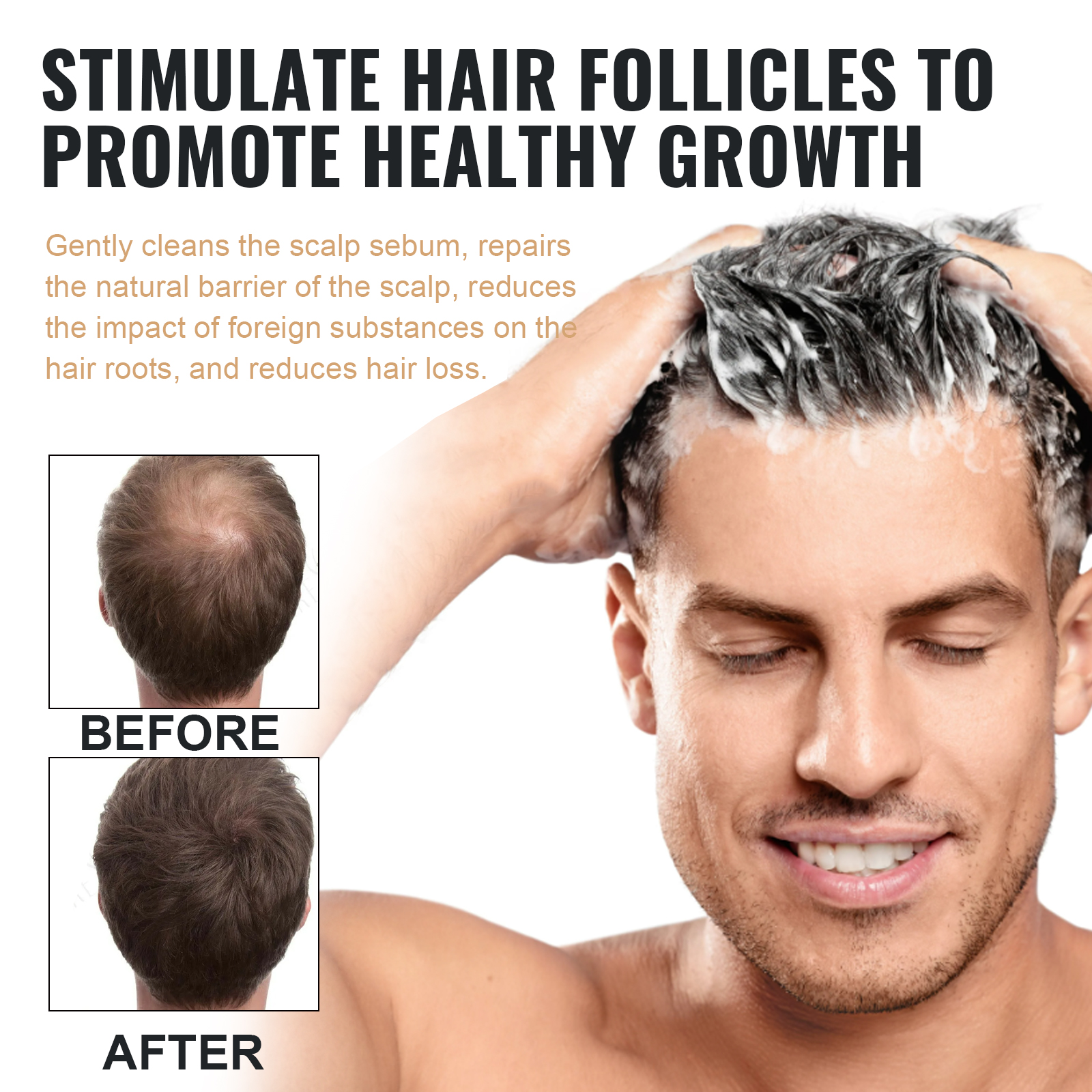 EELHOE 100ml Dense Hair Shampo - Hair Care For Hair Fall incelemesi ve fiyatı