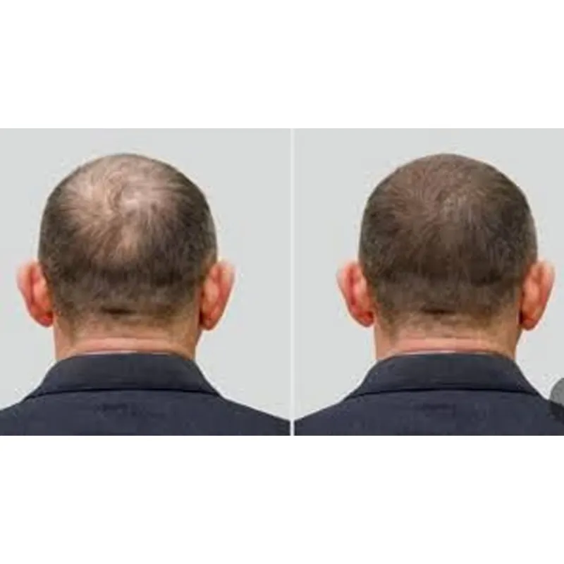 Good Seal Ozone Cap Ozone Hat  - Hair Care Good Hair incelemesi ve fiyatı